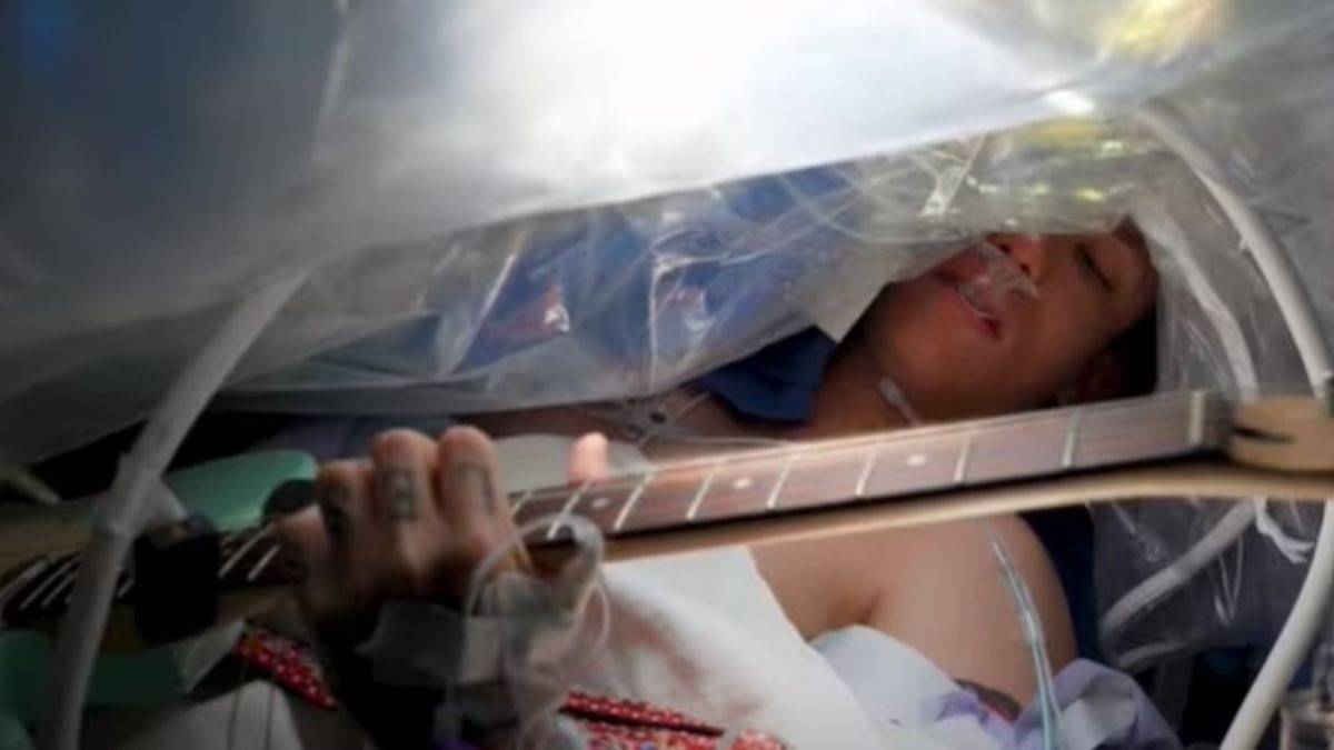 सर्जरी के दौरान शख्स ने बजाया गिटार (तस्वीर- YouTube/@SylvesterCancer)