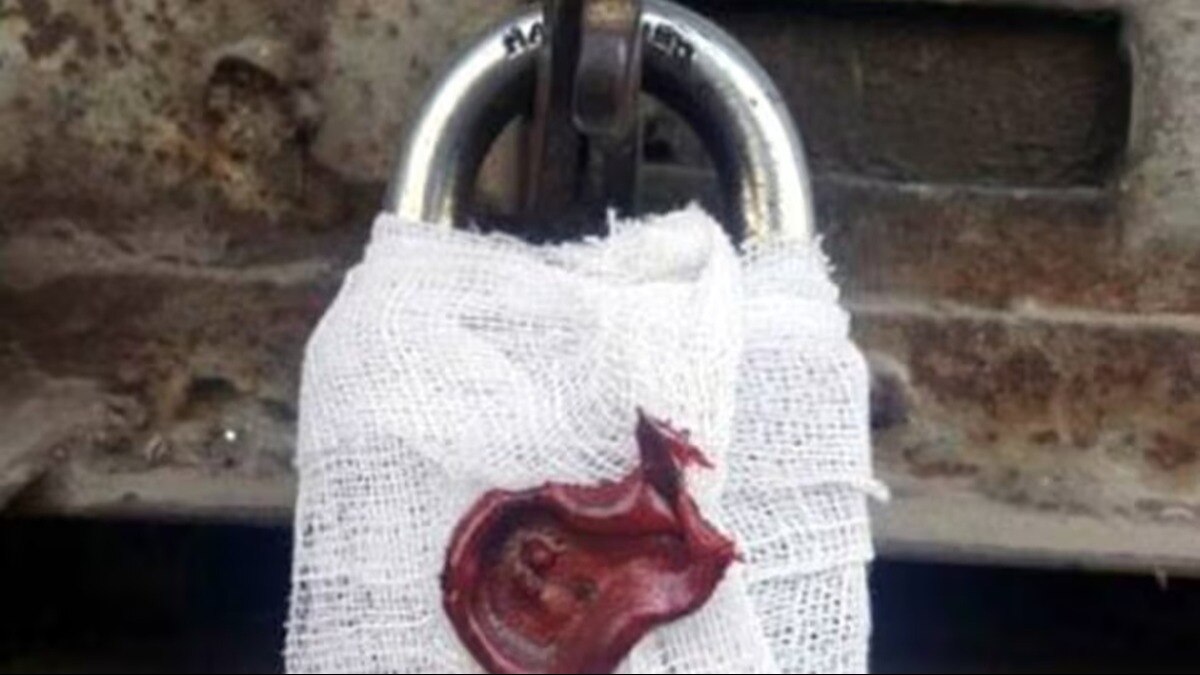 फर्जी नर्सिंग होम को स्वास्थ विभाग ने किया सील, मौके से संचालक और कर्मचारी हुए फरार