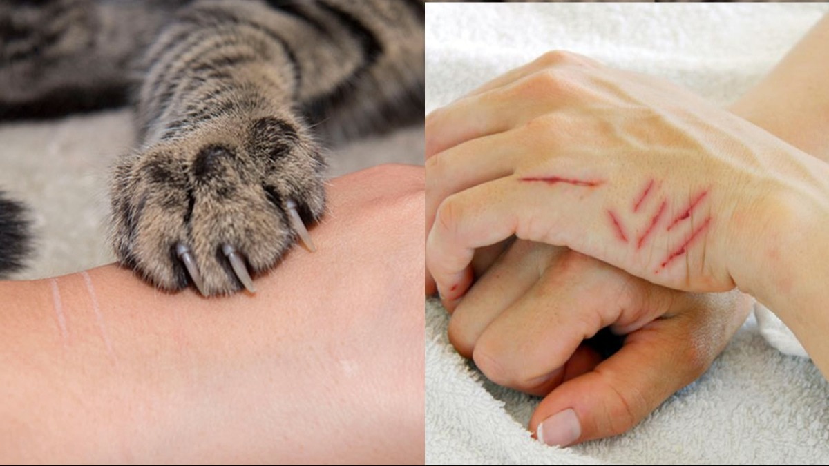 सिर्फ एक आवारा बिल्ली के कारण यहां मौत के मुंह में चला गया इंसान