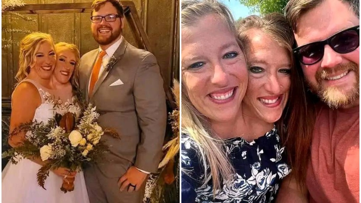 दोनों बहनें जन्म से जुड़ी हुई हैं (तस्वीर- CelebrityThings/Facebook)