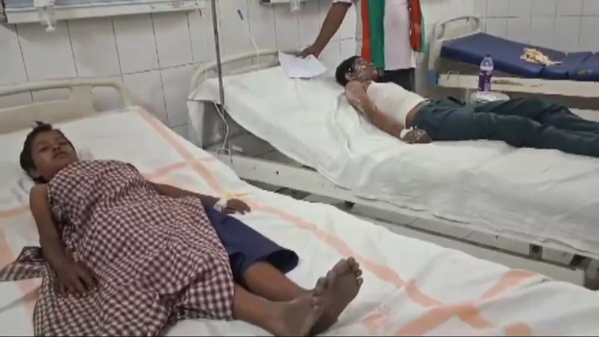 आग से झुलसे बच्चों का अस्पताल में चल रहा है इलाज.