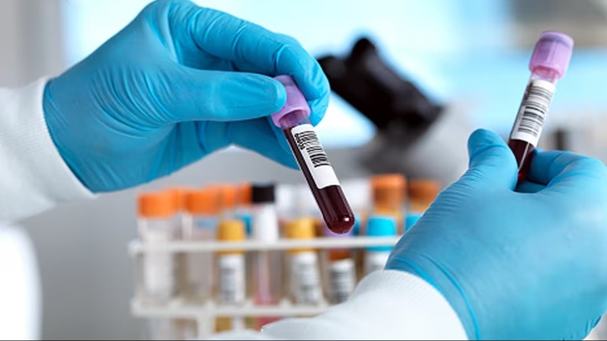 प्रतीकात्मक तस्वीर