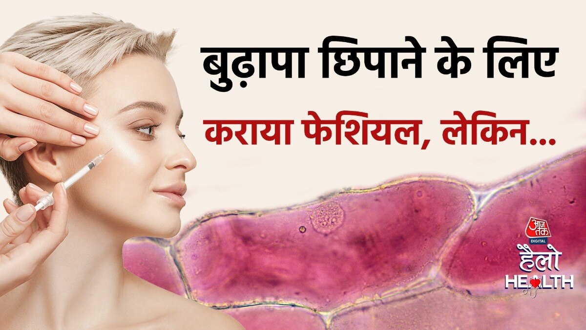 वैम्पायर फेशियल से तीन लोगों को एचआईवी का संक्रमण हो गया (Photo- Reuters