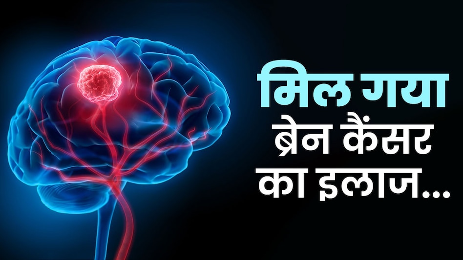 the voice of hind- ब्रेन कैंसर की बीमारी से मरीज को मिलेगा छुटकारा, IIT दिल्ली के छात्र ने बनाई दवाई