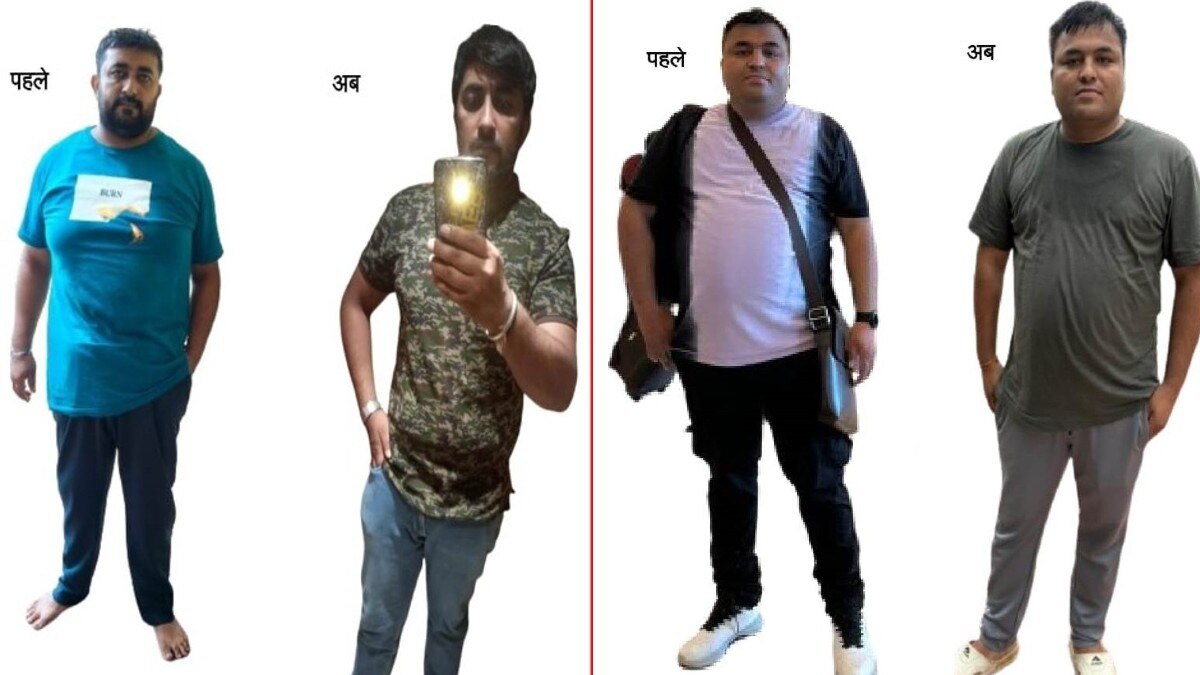 AIIMS भोपाल मोटापे के मरीजों के लिए बना वरदान.