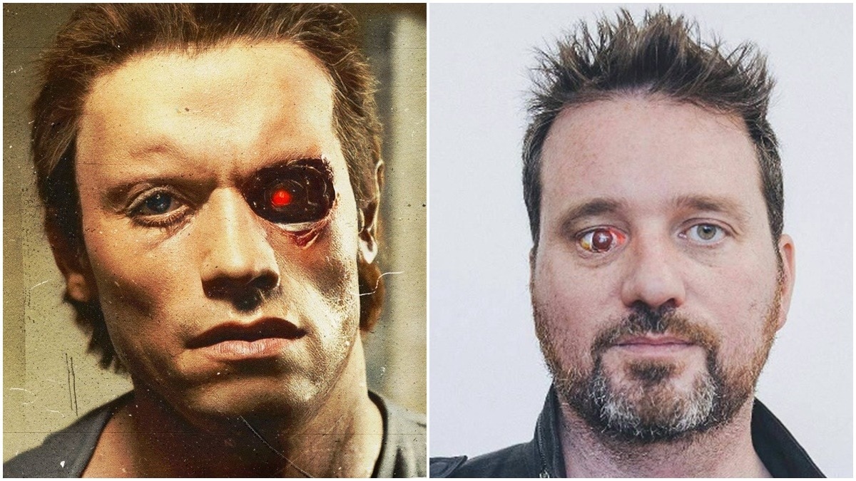 फिल्म मेकर Rob Spence ने आंख हटाकर कैमरा लगाया.