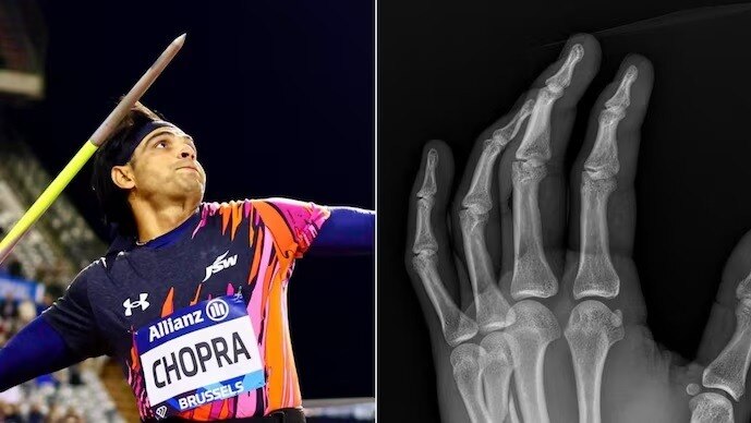 स्टार जैवलिन थ्रोअर नीरज चोपड़ा.