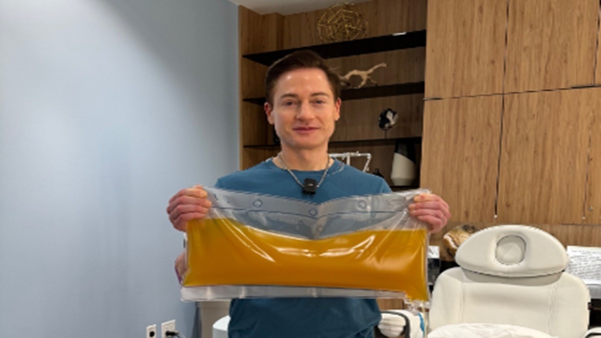  प्लाज्मा थेरेपी से जवान बनाने का दावा (फोटो - सोशल मीडिया)