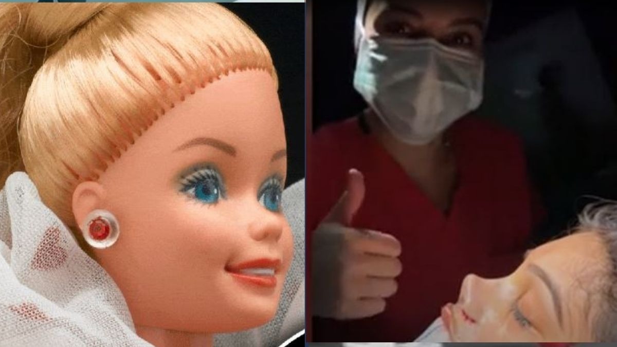 बार्बी डॉल जैसी नाक का था सपना, सर्जरी से बदल गई शक्ल! बताई आपबीती-