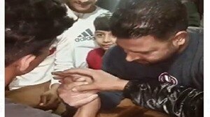 हाथ टूटने से कराहने लगा शख्स