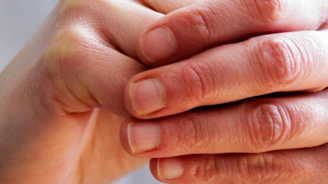 सूरत में शख्स की कटी उंगलियां बनी रहस्य का कारण (सांकेतिक तस्वीर)