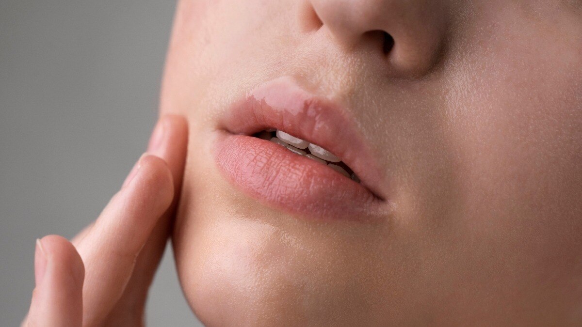 फटे होंठ हो जाएंगे मुलायम, ट्राई करें ये घरेलू नुस्खे