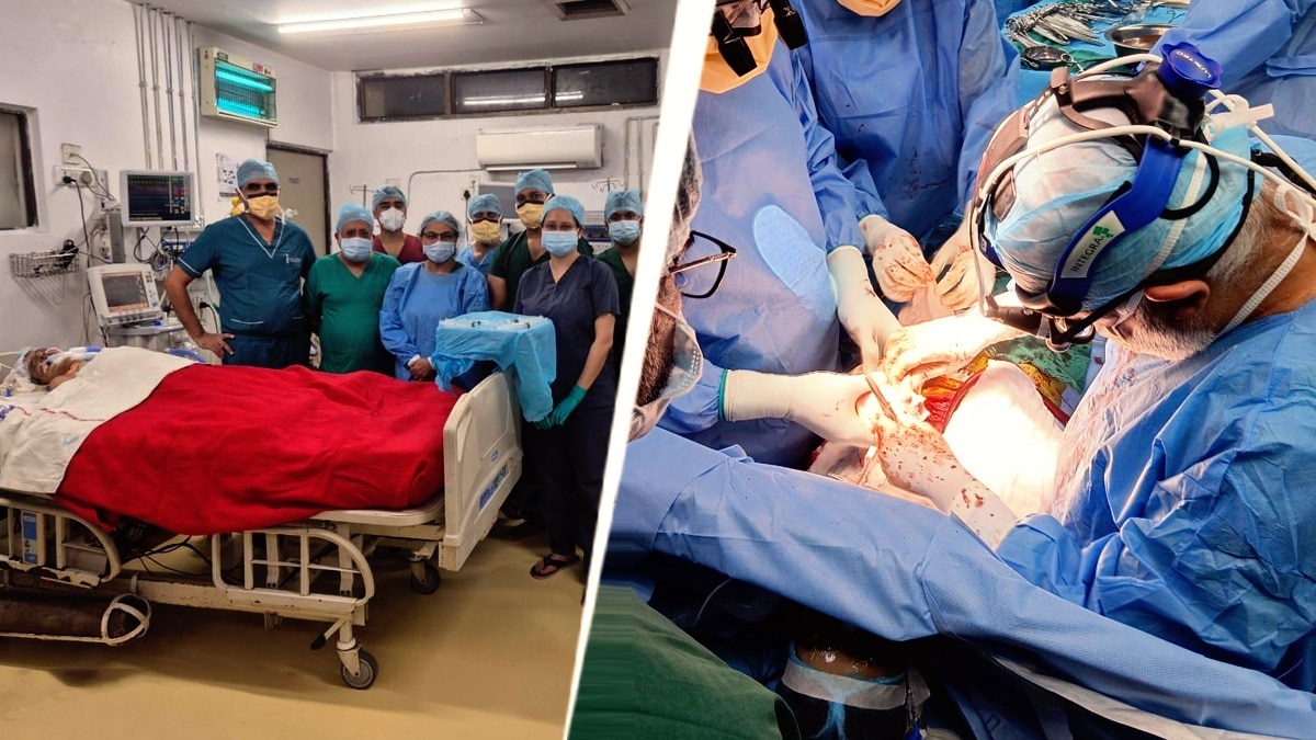 RML के डॉक्टरों ने किया हार्ट ट्रांसप्लांट 