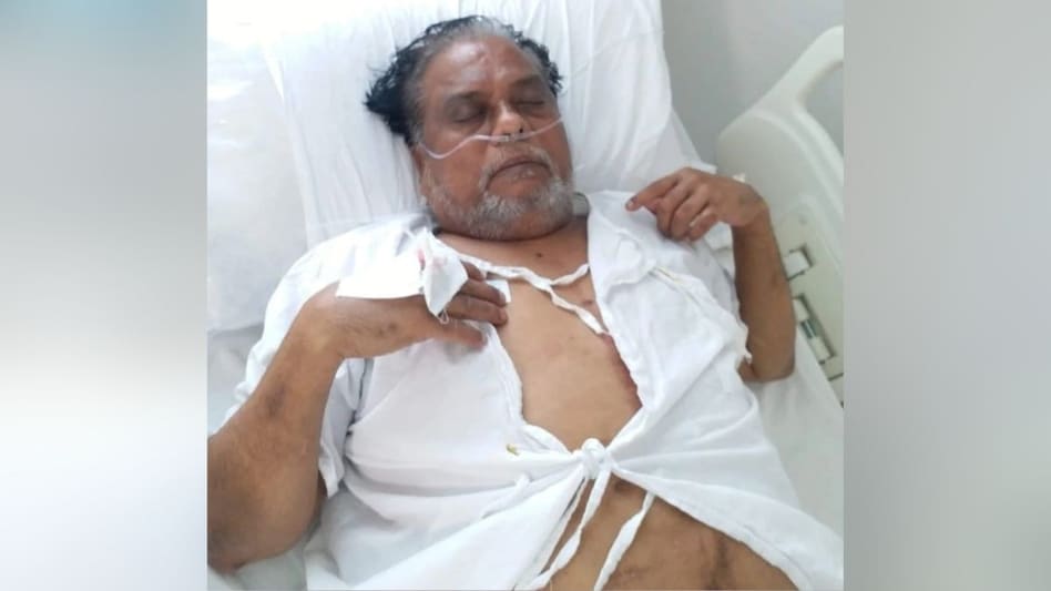 छोटा राजन की यह तस्वीर पहले की है, जब उसे अस्पताल में भर्ती कराया गया था. (File Photo) छोटा राजन की यह तस्वीर पहले की है, जब उसे अस्पताल में भर्ती कराया गया था. (File Photo)
