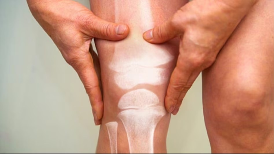 Bone care. Symbolic image