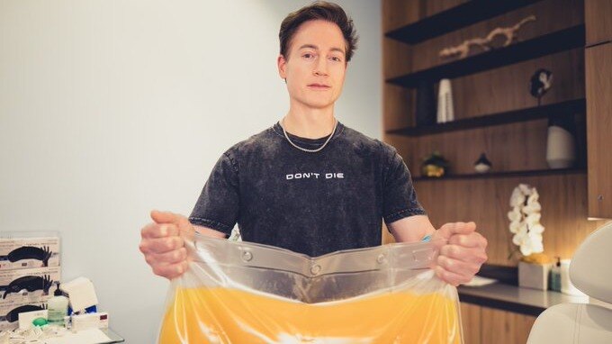 प्लाजमा दान कर रहा ये शख्स (फोटो - X/@bryan_johnson)