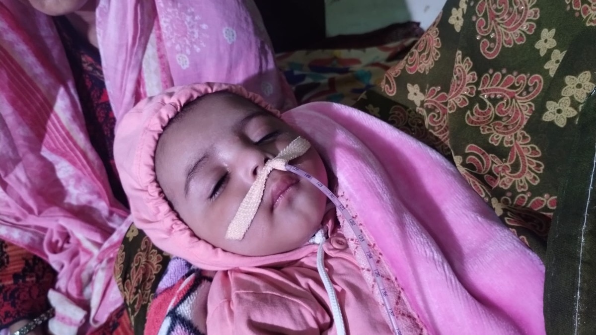 जयपुर के बच्चे को जेनेटिक बीमारी