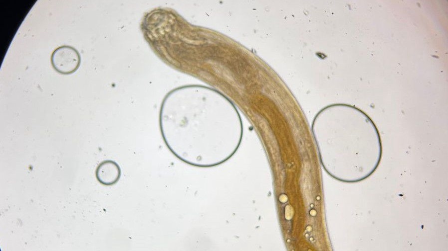 'ग्नाथोस्टोमा स्पिनिजेरम'.