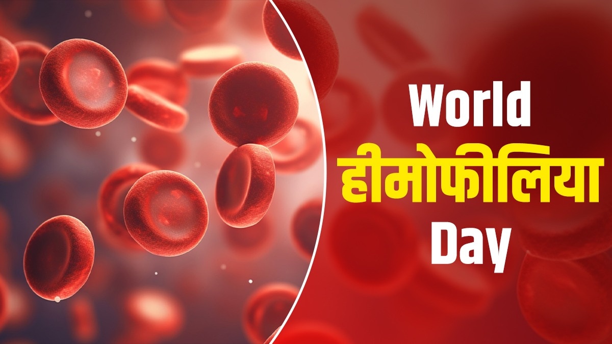 क्या होती है हीमोफीलिया बीमारी?
