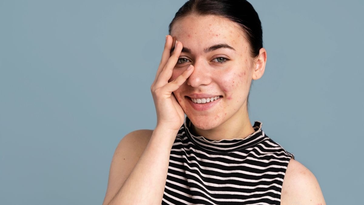 चेहरे पर नजर आते हैं बीमारियों के लक्षण