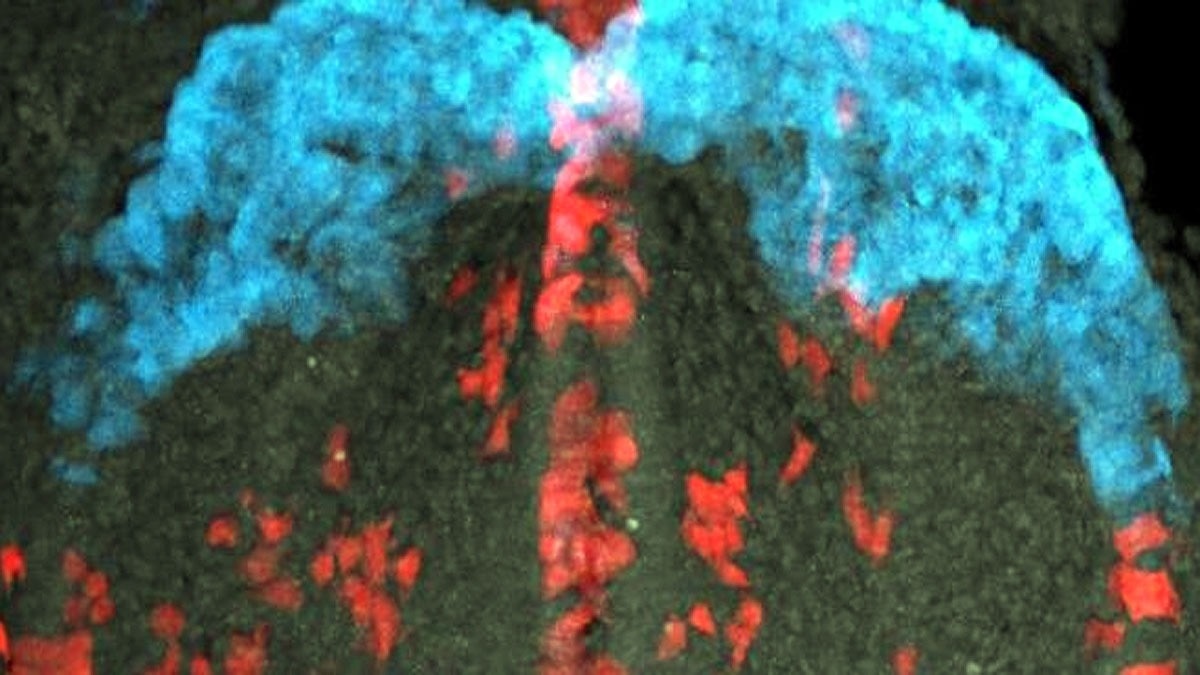 How a Heart is Formed