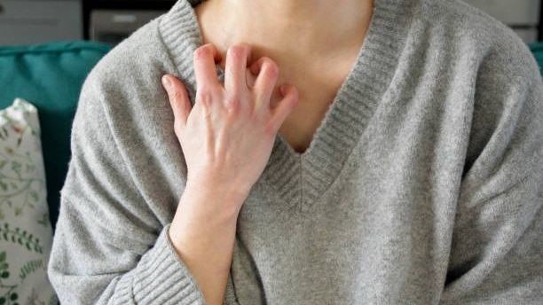 fat may raise risk of psoriasis