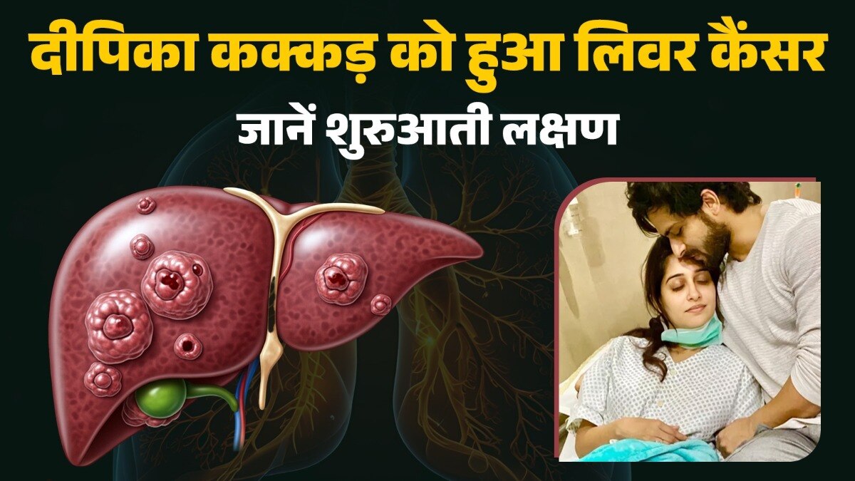 दीपिका कक्कड़ को हुआ लिवर कैंसर की शिकायत हुई है.