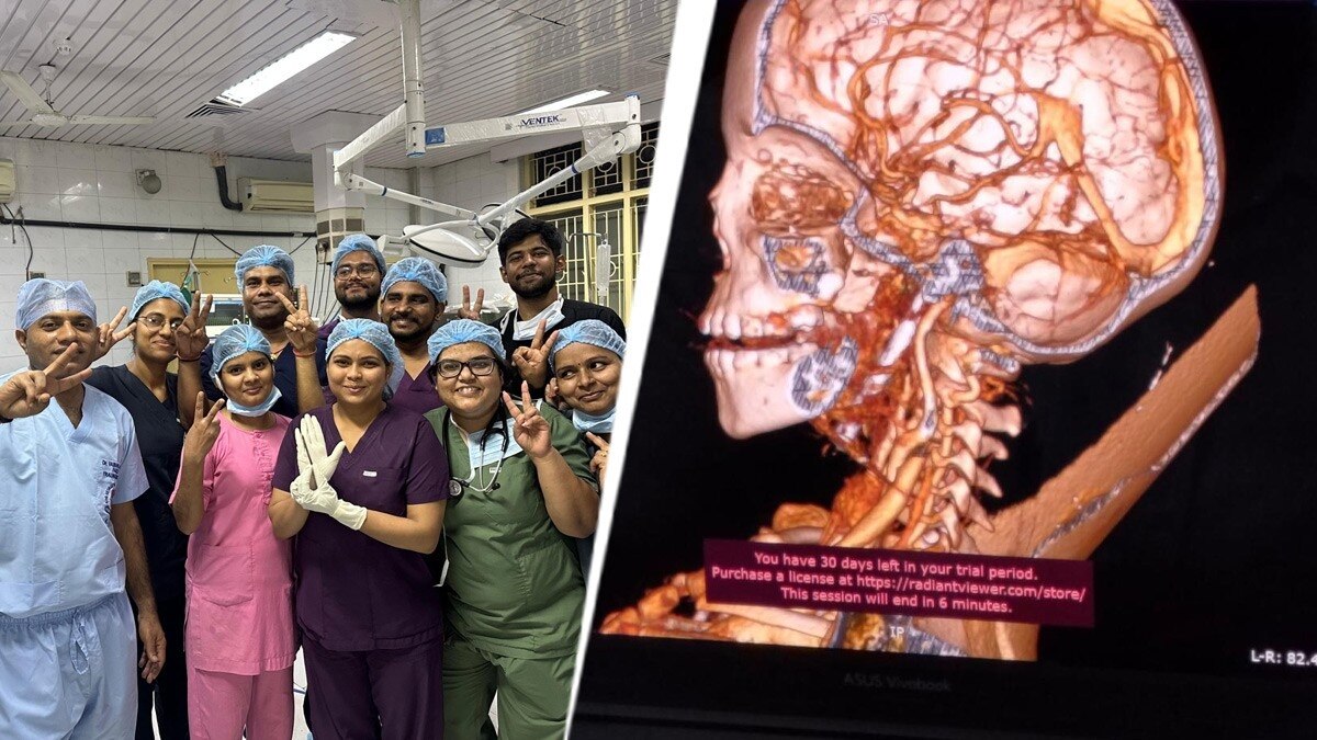 बच्ची की गर्दन में घुसी कील, डॉक्टरों ने बचाई जान