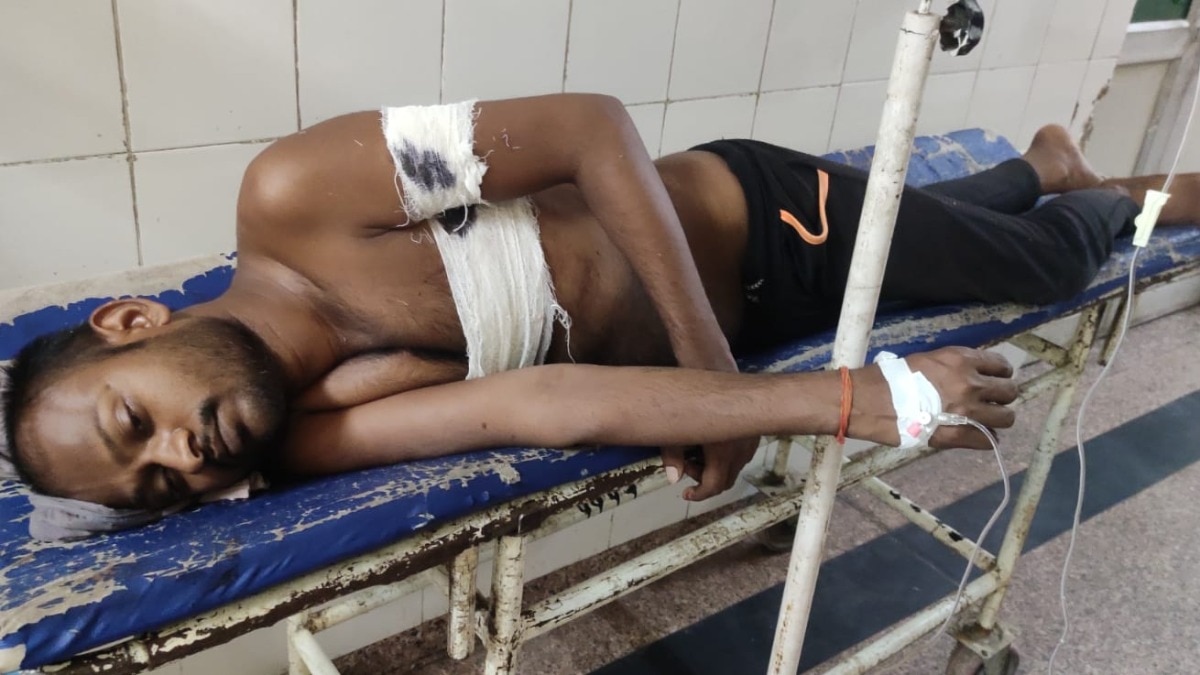 आरोपी पर फायरिंग.