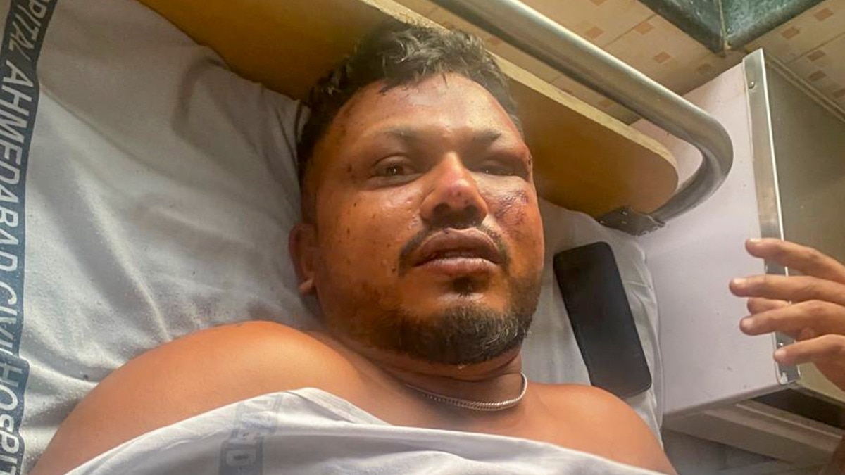 अहमदाबाद विमान हादसे में बचा शख्स