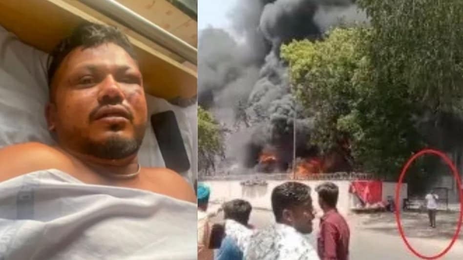 Ahmedabad Plane Crash: हादसे में बचे एकमात्र यात्री विश्वास कुमार रमेश को लेकर विवादित बयान। 2 अहमदाबाद प्लेन हादसे में बचे रमेश विश्वास कुमार का एक और वीडियो वायरल, बीजे मेडिकल हॉस्टल से बाहर निकलते दिखे - ahmedabad plane crash survivor vishwas kumar second ...