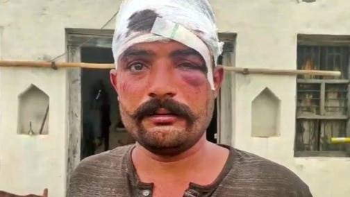 बागपत में पिटाई के बाद घायल दामाद 