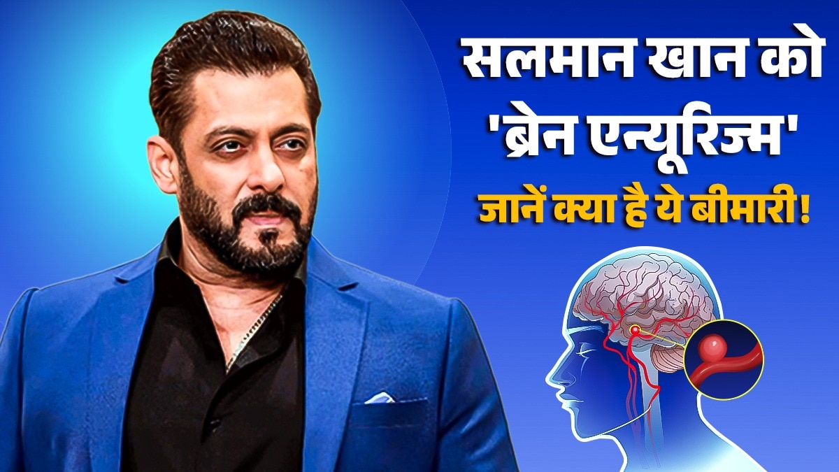 सलमान खान ने बताया है कि उन्हें  ब्रेन एन्यूरिज्म नाम की बीमारी है.