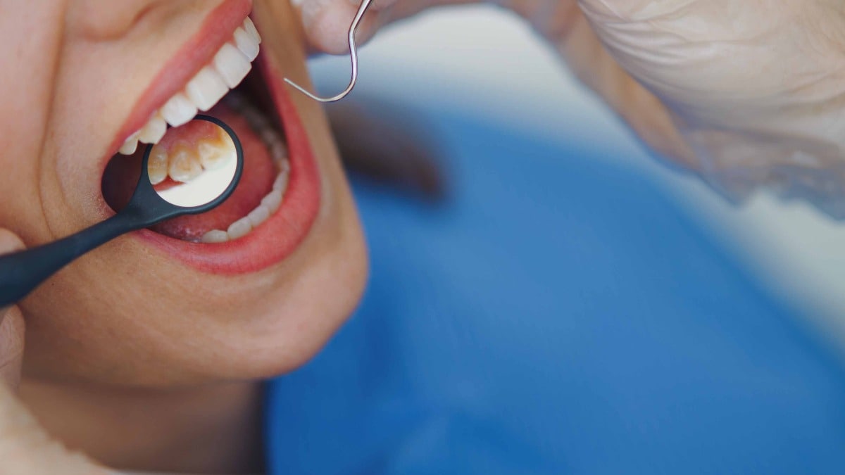 Oral care of your teeth: दांतों को रखना चाहते हैं कैविटी से दूर? इन सिंपल टिप्स को करें फॉलो - What are the proper steps for oral care Take care of your