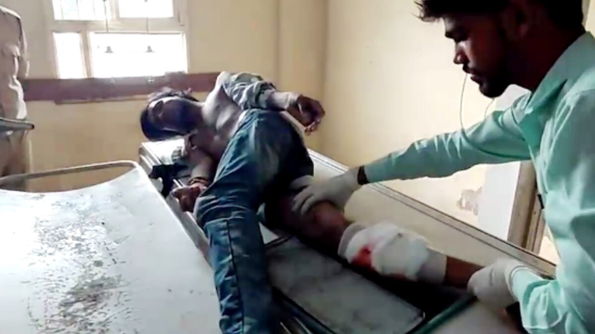 इनामी बदमाश कौशल गुर्जर शॉर्ट एनकाउंटर में घायल.