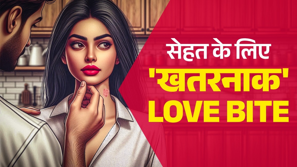 हिक्की को आम भाषा में लव बाइट भी बोलते हैं.