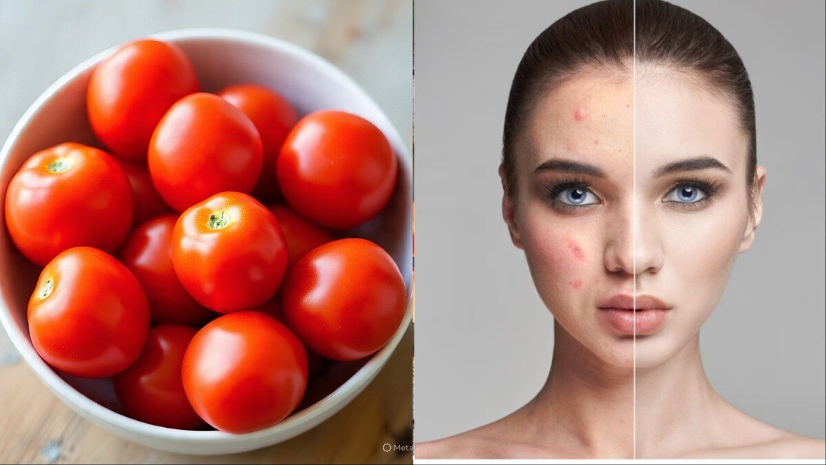 benefits of eating tomatoes