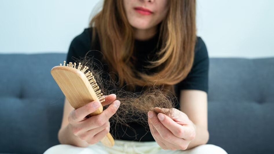 Hair Fall