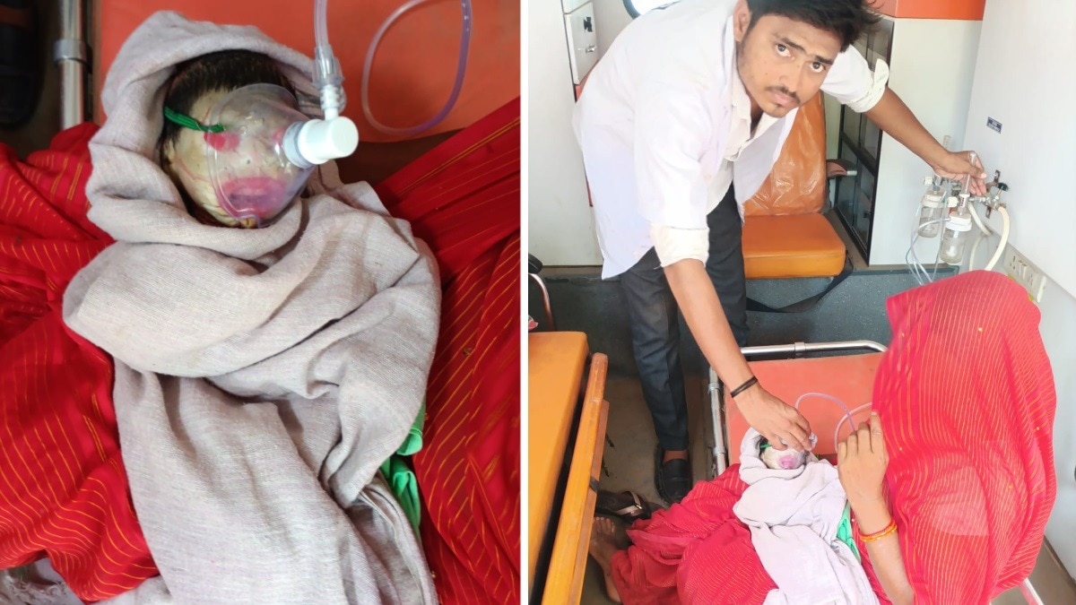 MP में जन्मा 'एलियन बेबी'... सफेद त्वचा में दरारें, आंखें-नाक-कान से लेकर पूरा शरीर कटा-फटा