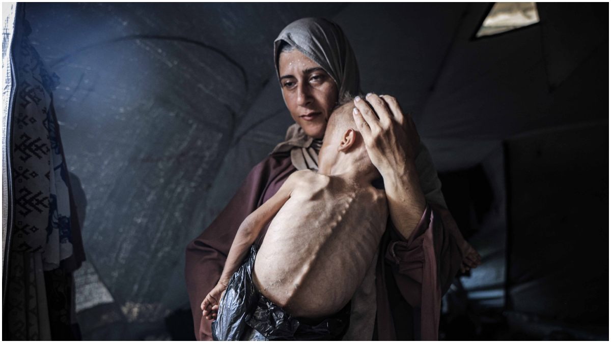 Gaza Starvation child Photo