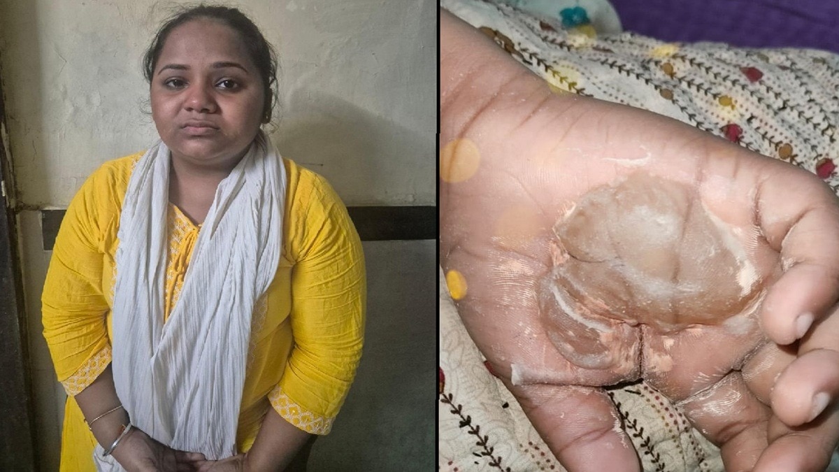 खराब हैंडराइटिंग पर भड़की ट्यूशन टीचर, जलती मोमबत्ती पर रख दिया मासूम का हाथ