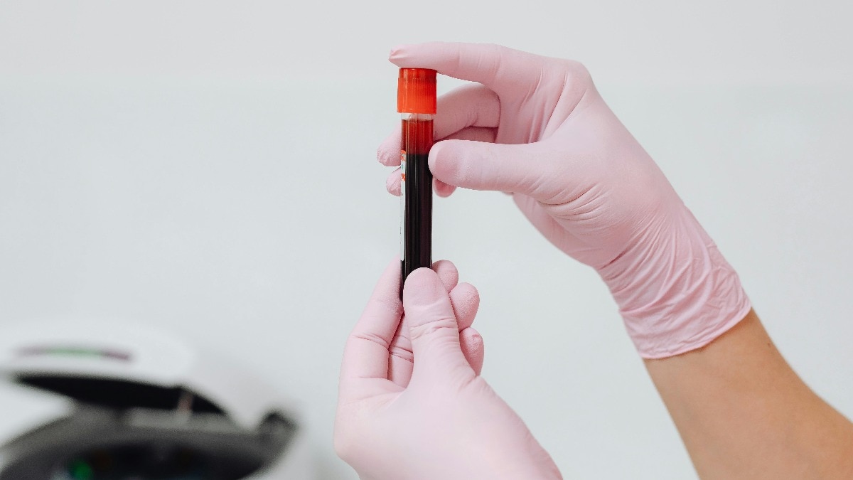 Blood sample 