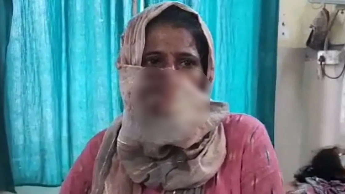 Husband cut off wife's nose (Photo- ITG)
