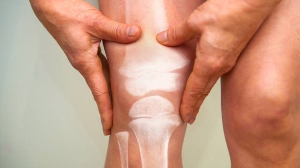 हड्डियों के स्वास्थ्य के लिए क्या खाना चाहिए (PC: Getty)