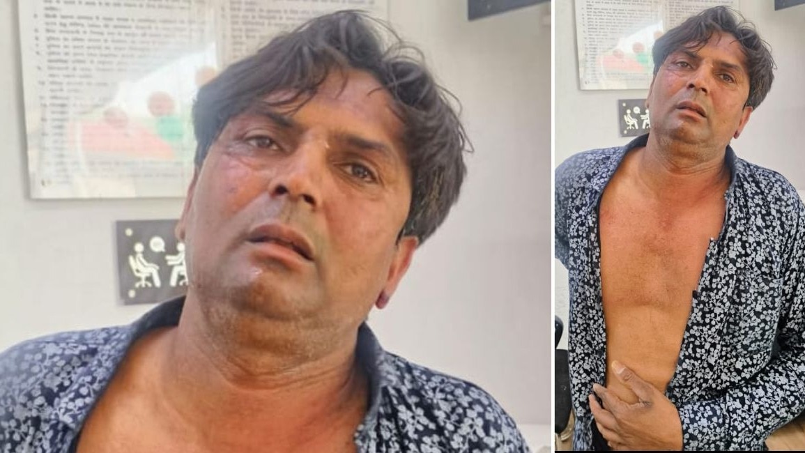 दिल्ली सीएम रेखा गुप्ता पर जनसुनवाई के दौरान इसी शख्स ने हमला किया है. (Photo- ITG)