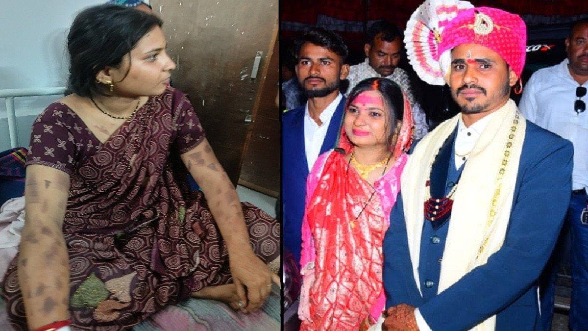 woman burnt with hot knife