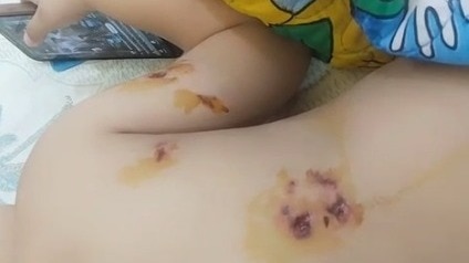 पूर्वी दिल्ली में कुत्ते ने बच्चे को काटा, परिवार ने बचाया. (Photo- Screengrab)