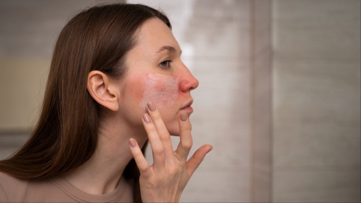 hidden reasons why your skin remains dry despite daily care (Photo: Freepik)