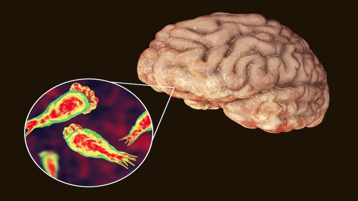 symbolic image of infection in brain 