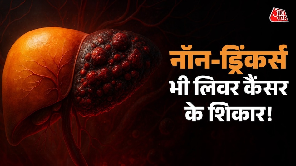 AI Generated) AI Generated)